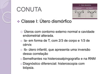 CONUTA
 Classe I: Útero dismórfico
o Úteros com contorno externo normal e cavidade
endometrial alterada.
o Ia- em forma de T, com 2/3 de corpo e 1/3 de
cérvix
o Ib- útero infantil, que apresenta uma inversão
dessa correlação
o Semelhantes na histerossalpingografia e na RNM
o Diagnóstico diferencial: histeroscopia com
biópsia.
 