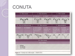 CONUTA
• 6-9ªsem
• 10-12ª sem
• 13-17ª sem
 