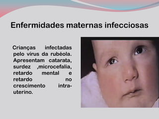 Enfermidades maternas infecciosas 
Crianças infectadas pelo vírus da rubéola. Apresentam catarata, surdez ,microcefalia, retardo mental e retardo no crescimento intra- uterino.  