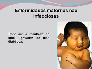 Enfermidades maternas não infecciosas 
Pode ser o resultado de uma gravidez de mãe diabética.  