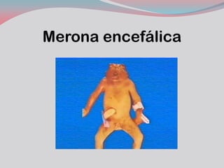 Merona encefálica  