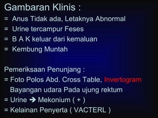 Malformasi ano rektal | PPT