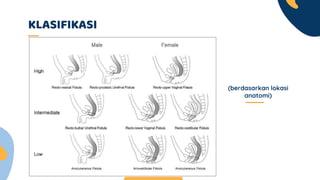 KLASIFIKASI
(berdasarkan lokasi
anatomi)
 