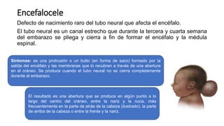 Malformaciones CONGENITAaaaS _112209.pptx