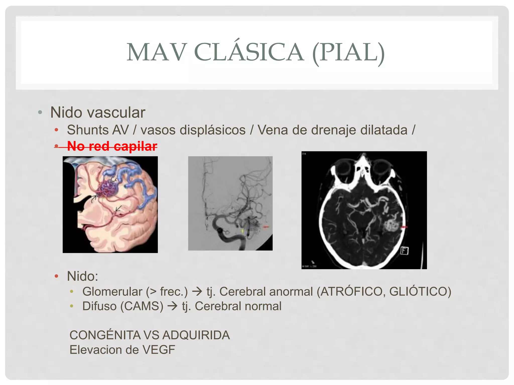 Malformaciones vasculares cerebrales | PPT