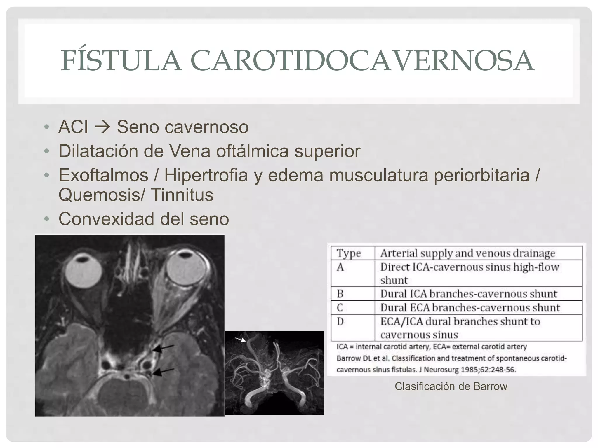 Malformaciones vasculares cerebrales | PPTX