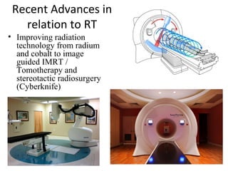 Recent Advances in
relation to RT
• Improving radiation
technology from radium
and cobalt to image
guided IMRT /
Tomotherapy and
stereotactic radiosurgery
(Cyberknife)

 