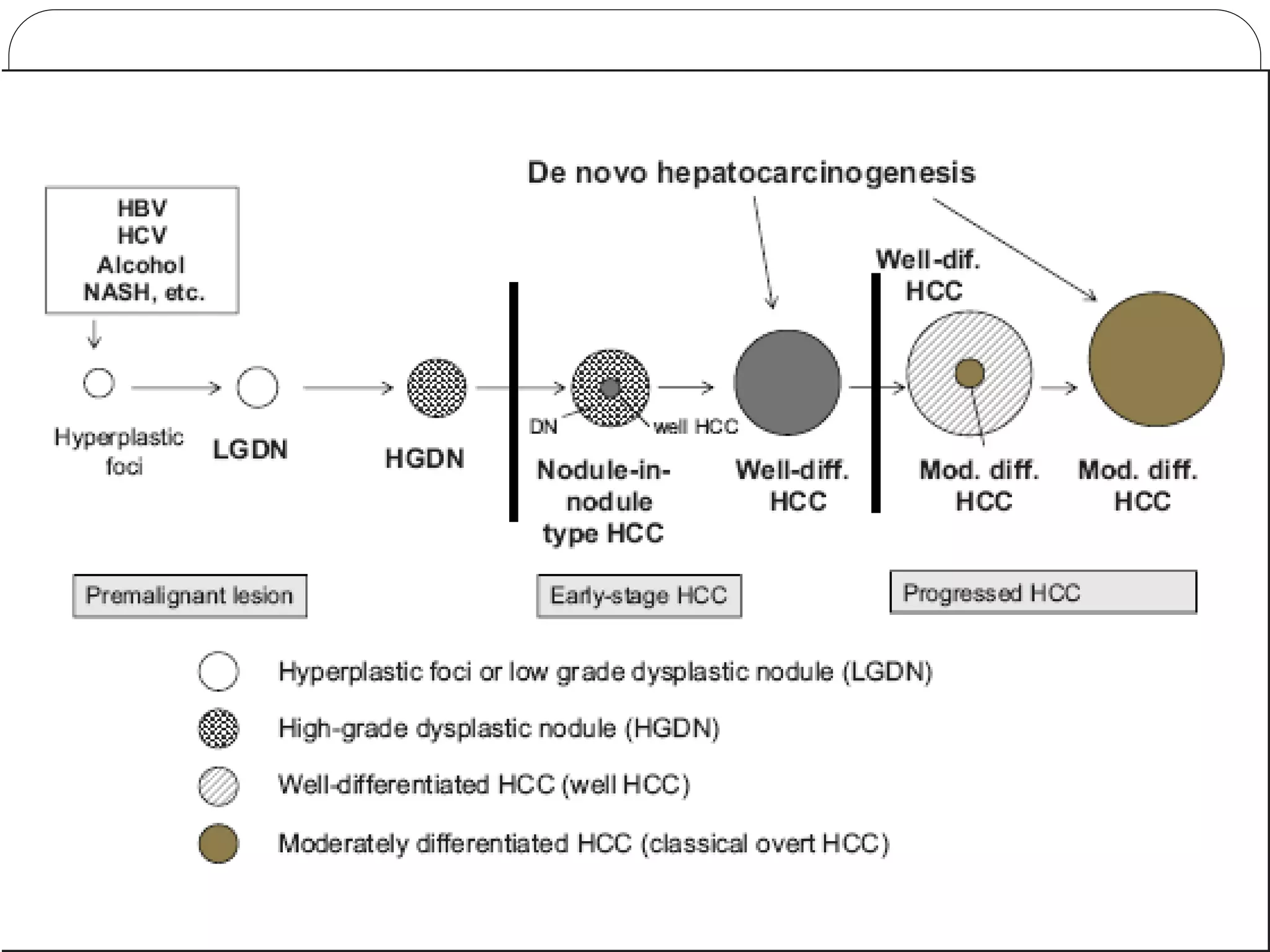 HEPATOCELLULAR CARCINOMA RADIOLOGY | PPTX