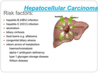 Risk factors:
 hepatitis B (HBV) infection
 hepatitis C (HCV) infection
 alcoholism
 biliary cirrhosis
 food toxins e.g. aflatoxins
 congenital biliary atresia
 inborn errors of metabolism
haemochromatosis
alpha-1 antitrypsin deficiency
type 1 glycogen storage disease
Wilson disease
Hepatocellular Carcinoma
 