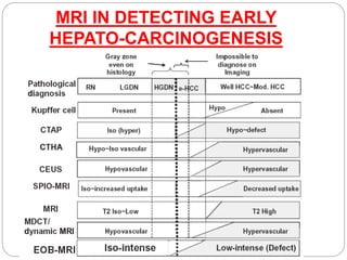 MRI IN DETECTING EARLY
HEPATO-CARCINOGENESIS
 