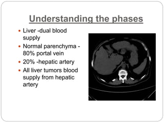 Understanding the phases
 Liver -dual blood
supply
 Normal parenchyma -
80% portal vein
 20% -hepatic artery
 All liver tumors blood
supply from hepatic
artery
 