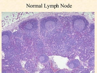 Normal Lymph Node 