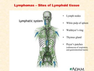 Lymphomas – Sites of Lymphoid tissue Lymph nodes White pulp of spleen Waldeyer’s ring Thymus gland Peyer’s patches  (submucosa of   respiratory and gastrointestinal tracts) 