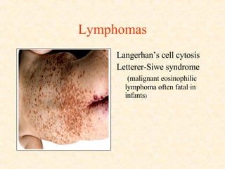 Lymphomas Langerhan’s cell cytosis Letterer-Siwe syndrome (malignant eosinophilic lymphoma often fatal in infants ) 