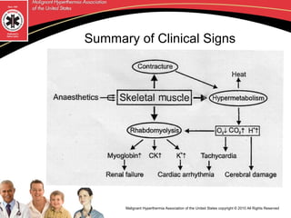 Malignant Hyperthermia Syndrome | PPT
