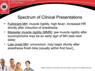 Malignant Hyperthermia Syndrome | PPT