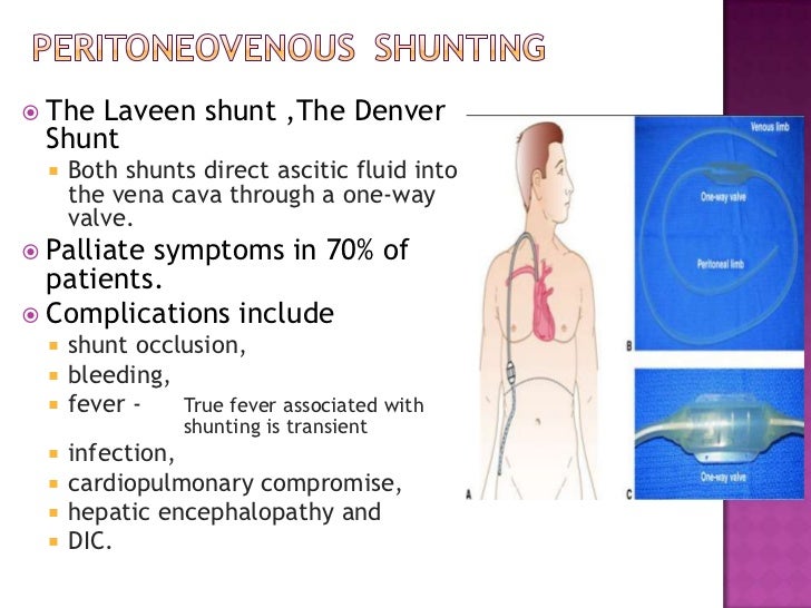 Malignant ascites dr. varun