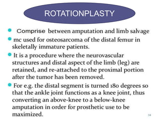 Malignant bone tumor | PPTX