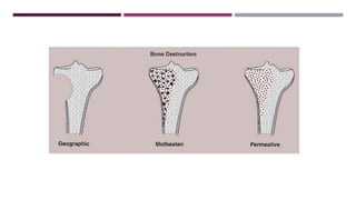 Comprehensive Overview of Malignant Bone Tumors: Diagnosis and Imaging ...