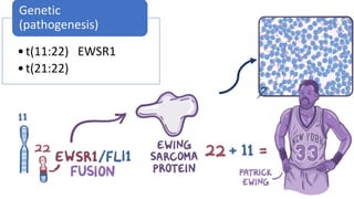 •t(11:22) EWSR1
•t(21:22)
Genetic
(pathogenesis)
 