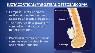 JUXTACORTICAL/PAROSTEAL OSTEOSARCOMA
• Comprise 1% of all primary
malignant bone tumours and
about 4% of all osteosarcomas .
• The tumous is slow growing by
comparison and has a much
better prognosis .
• Parosteal sarcomas occur most
commonly on the distal femur
and proximal humerus .
 