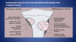 Radiographic features that may help differentiate benign from
malignant lesions
 