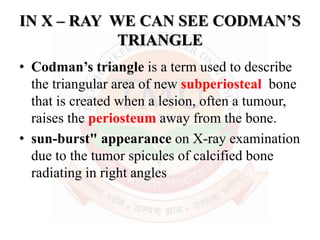 Malignant bone tumours | PPTX