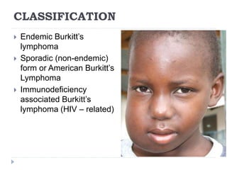 CLASSIFICATION
 Endemic Burkitt’s
lymphoma
 Sporadic (non-endemic)
form or American Burkitt’s
Lymphoma
 Immunodeficiency
associated Burkitt’s
lymphoma (HIV – related)
 