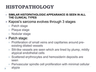 HISTOPATHOLOGY
 SIMILAR HISTOPATHOLOGIC APPEARANCE IS SEEN IN ALL
THE CLINICAL TYPES
 Kaposi’s sarcoma evolves through 3 stages
 Patch stage
 Plaque stage
 Nodular stage
 Patch stage:
 Proliferation of small veins and capillaries around pre-
existing dilated vessels
 Slit-like vessels are seen which are lined by plump, mildly
atypical endothelial cells
 Scattered erythrocytes and hemosiderin deposits are
seen
 Perivascular spindle cell proliferation with minimal cellular
atypia
 