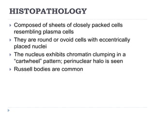 HISTOPATHOLOGY
 Composed of sheets of closely packed cells
resembling plasma cells
 They are round or ovoid cells with eccentrically
placed nuclei
 The nucleus exhibits chromatin clumping in a
“cartwheel” pattern; perinuclear halo is seen
 Russell bodies are common
 