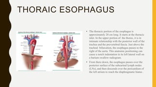 Anatomy and malignant diseases of esophagus | PPTX
