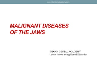 MALIGNANT DISEASES
OF THE JAWS
INDIAN DENTAL ACADEMY
Leader in continuing Dental Education
www.indiandentalacademy.com
 