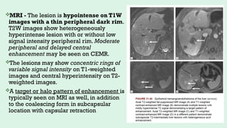 Sle Pattern Periphiral Rim Fana Malignant focal liver lesions: A Radiologist's Perspective | PPTX