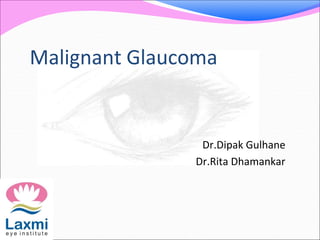 Malignant Glaucoma
Dr.Dipak Gulhane
Dr.Rita Dhamankar
 