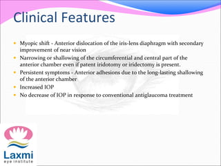 Clinical Features 
 Myopic shift - Anterior dislocation of the iris-lens diaphragm with secondary 
improvement of near vision 
 Narrowing or shallowing of the circumferential and central part of the 
anterior chamber even if patent iridotomy or iridectomy is present. 
 Persistent symptoms - Anterior adhesions due to the long-lasting shallowing 
of the anterior chamber 
 Increased IOP 
 No decrease of IOP in response to conventional antiglaucoma treatment 
 