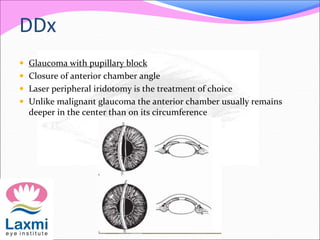 DDx 
 Glaucoma with pupillary block 
 Closure of anterior chamber angle 
 Laser peripheral iridotomy is the treatment of choice 
 Unlike malignant glaucoma the anterior chamber usually remains 
deeper in the center than on its circumference 
 