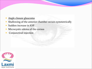  Angle closure glaucoma 
 Shallowing of the anterior chamber occurs symmetrically 
 Sudden increase in IOP 
 Microcystic edema of the cornea 
 Conjunctival injection 
 