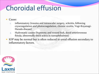 Choroidal effusion 
 Cause: 
1. inflammatory (trauma and intraocular surgery, scleritis, following 
cryocoagulation and photocoagulation, chronic uveitis, Vogt-Koyanagi- 
Harada disease) 
2. Hydrostatic causes (hypotony and wound leak, dural arteriovenous 
fistula, abnormally thick sclera in nanophthalmos) 
 IOP may be normal but is often reduced in uveal effusion secondary to 
inflammatory factors. 
 
