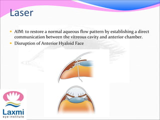 Laser 
 AIM: to restore a normal aqueous flow pattern by establishing a direct 
communication between the vitreous cavity and anterior chamber. 
 Disruption of Anterior Hyaloid Face 
 