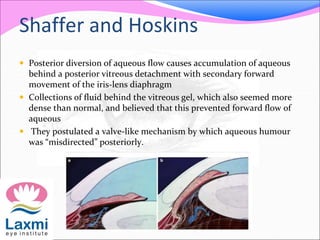 Shaffer and Hoskins 
 Posterior diversion of aqueous flow causes accumulation of aqueous 
behind a posterior vitreous detachment with secondary forward 
movement of the iris-lens diaphragm 
 Collections of fluid behind the vitreous gel, which also seemed more 
dense than normal, and believed that this prevented forward flow of 
aqueous 
 They postulated a valve-like mechanism by which aqueous humour 
was “misdirected” posteriorly. 
 