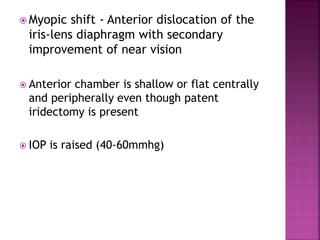  Myopic shift - Anterior dislocation of the
iris-lens diaphragm with secondary
improvement of near vision
 Anterior chamber is shallow or flat centrally
and peripherally even though patent
iridectomy is present
 IOP is raised (40-60mmhg)
 