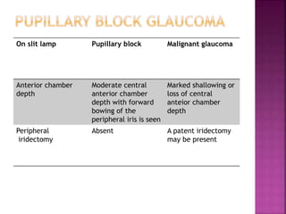On slit lamp Pupillary block Malignant glaucoma
Anterior chamber
depth
Moderate central
anterior chamber
depth with forward
bowing of the
peripheral iris is seen
Marked shallowing or
loss of central
anteior chamber
depth
Peripheral
iridectomy
Absent A patent iridectomy
may be present
 