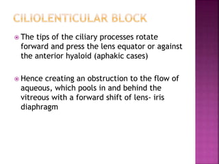  The tips of the ciliary processes rotate
forward and press the lens equator or against
the anterior hyaloid (aphakic cases)
 Hence creating an obstruction to the flow of
aqueous, which pools in and behind the
vitreous with a forward shift of lens- iris
diaphragm
 