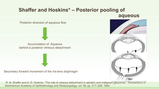 Shaffer and Hoskins* – Posterior pooling of
aqueous
Posterior diversion of aqueous flow
Accumulation of Aqueous
behind a posterior vitreous detachment
Secondary forward movement of the iris-lens diaphragm
R. N. Shaffer and H. D. Hoskins, “The role of vitreous detachment in aphakic and malignant glaucoma,” Transactions of
theAmerican Academy of Ophthalmology and Otolaryngology, vol. 58, pp. 217–228, 1954.
 
