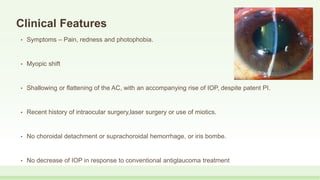 Clinical Features
• Symptoms – Pain, redness and photophobia.
• Myopic shift
• Shallowing or flattening of the AC, with an accompanying rise of IOP, despite patent PI.
• Recent history of intraocular surgery,laser surgery or use of miotics.
• No choroidal detachment or suprachoroidal hemorrhage, or iris bombe.
• No decrease of IOP in response to conventional antiglaucoma treatment
 