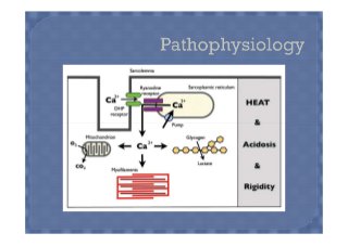Malignant hyperthermia | PPT