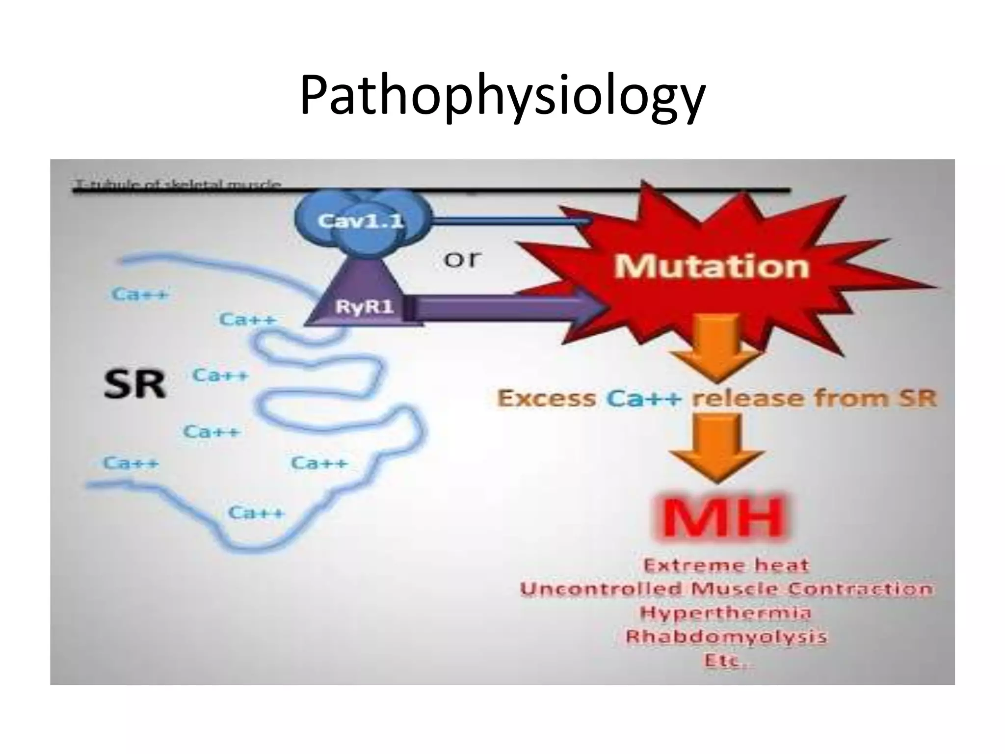 Malignant hyperthermia | PPTX