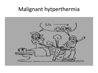 Malignant hytperthermia
 