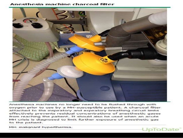 Malignant hyperthermia and dantrolene sodium Malignant hyperthermia and dantrolene sodium