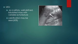  USG:
 as a solitary, well-defined,
lobulated mass with
variable echotexture
 calcification may be
seen(50%)
 
